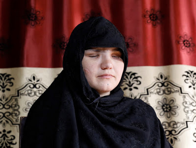 Afghan%2Bwoman%2Beyes%2Bare%2Bgouged%2Bwith%2Ba%2Bknife%2Bby%2BHER%2BOWN%2BFATHER%2Bfor%2Bdaring%2Bto%2Bget%2Ba%2Bjob.jpg