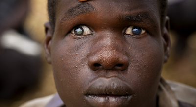 River%2Bblindness%2Bnow%2Bendemic%2Bin%2BAbuja%25E2%2580%2599s%2Bsix%2Bcouncils%2B1.png