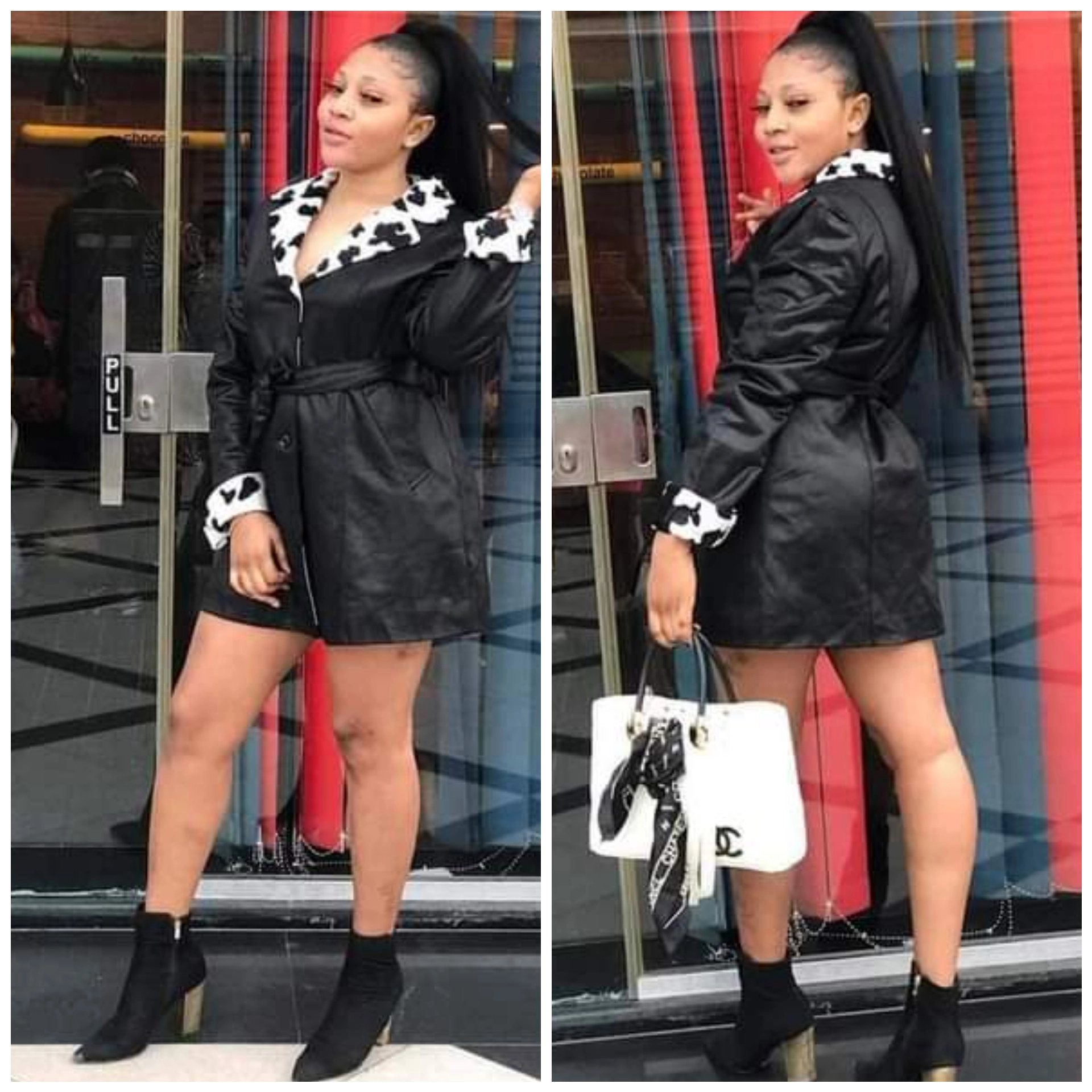 28 Year-Old Nigerian lady Reportedly Dies During Plastic Surgery
