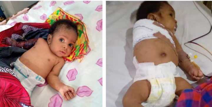 Father Allegedly Breaks 2 Month Old Baby’s Arm For Disturbing His Sleep Father Allegedly Breaks 2 Month Old Baby’s Arm For Disturbing His Sleep