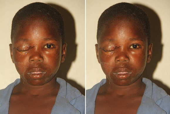 12-Year Old Boy's Eye Is Forcely Plucked Out In Bauchi1 bauchi