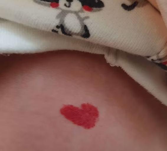 Birth Mark 