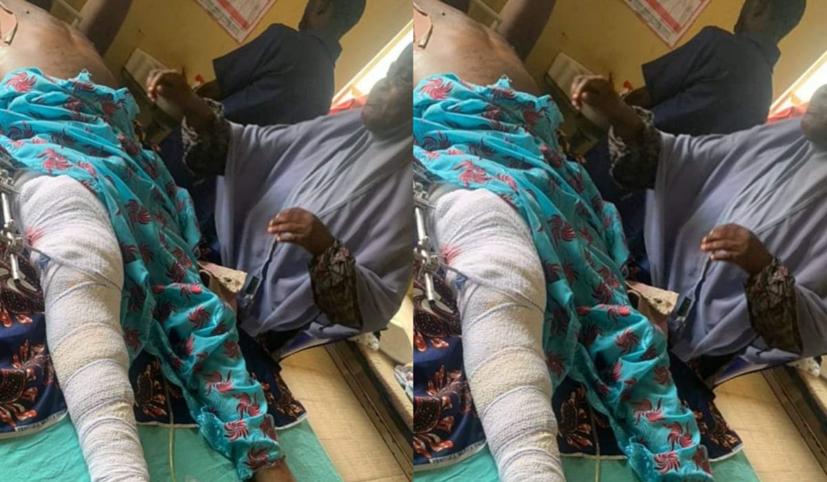 60-year-old man knocked down by suspected yahoo boy seeks government, Nigerians help yahoo boy