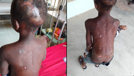 7-year old housemaid brutalised diagnosed with kidney housemaid