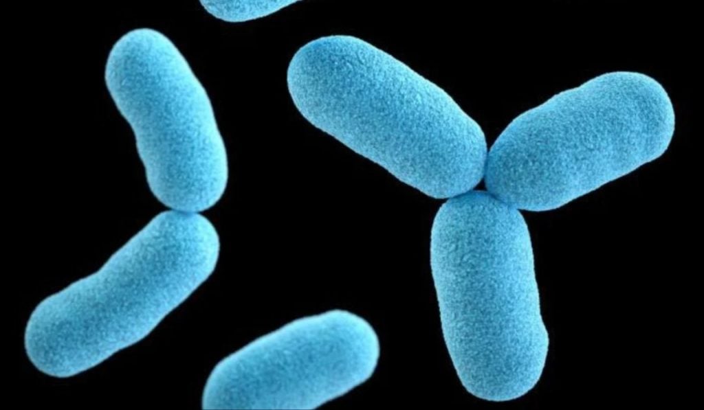 Outbreak of diphtheria, yellow fever in Bauchi
