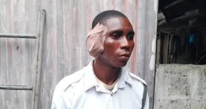 Driver bites off VIO officer’s ear in Delta VIO