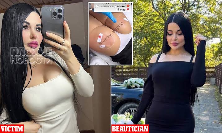 22-year-old woman undergoing buttock enlargement surgery DIES