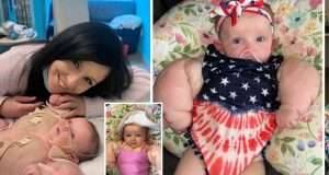 Newborn baby dubbed ‘MINI HULK’ Newborn baby dubbed 'MINI HULK'