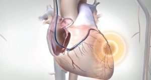 Organ Harvesting: 20-year old, lures boy, 17, to Abuja to have his kidney removed Organ Harvesting: 20-year old, lures boy, 17, to Abuja to have his kidney removed