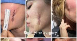 Khloe Kardashian gets candid about her ‘skin cancer journey’ Khloe Kardashian gets candid about her 'skin cancer journey'