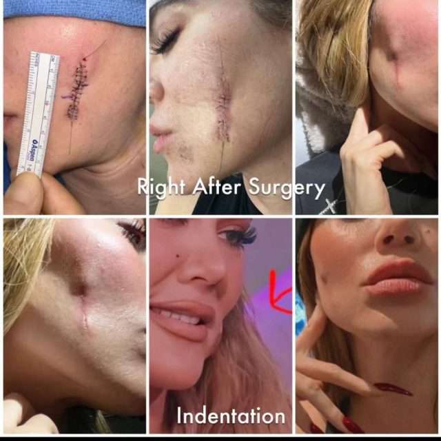 20230920_085610_1695196785ladunliadisnews.com_ Khloe Kardashian gets candid about her 'skin cancer journey'