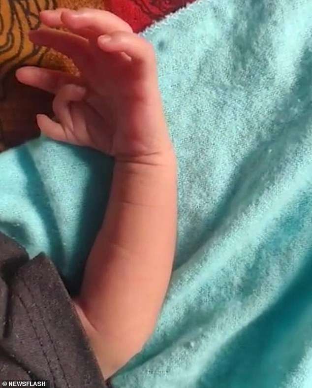 Baby born with 14 fingers and 12 toes in India