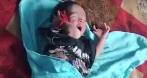 Baby born with 14 fingers and 12 toes in India Baby born with 14 fingers and 12 toes in India