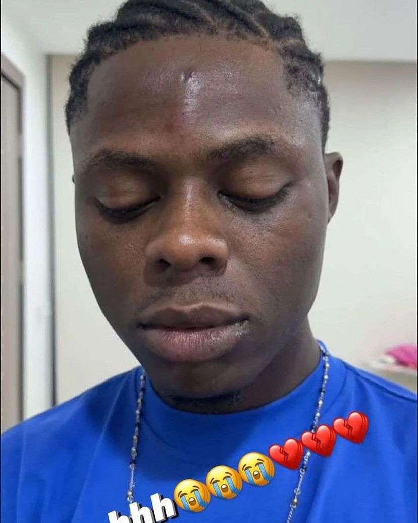 Heartbreaking photos of Mohbad with injuries on his face 