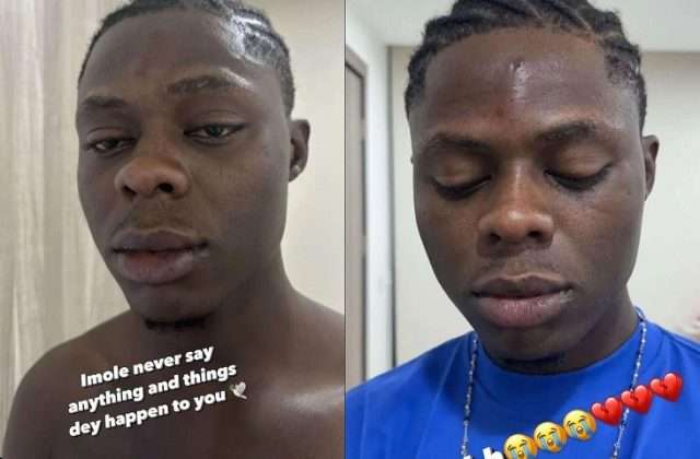 Heartbreaking photos of Mohbad with injuries on his face 