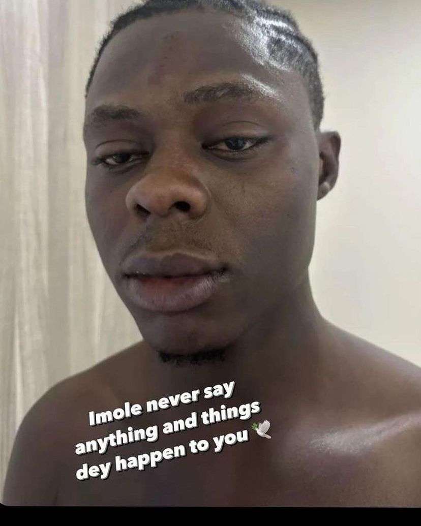 Heartbreaking photos of Mohbad with injuries on his face 