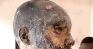 Woman bathes husband with hot oil over disagreement