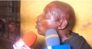 Police to probe attack on officer at political rally in Kogi Police to probe attack on officer at political rally in Kogi