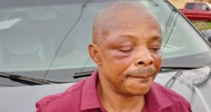 Imo protest: Ajaero in hospital, battles to save right eye Imo protest: Ajaero in hospital, battles to save right eye