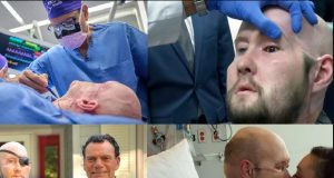 Surgeons perform first whole eye transplant Surgeons perform first whole eye transplant