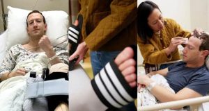 Mark Zuckerberg undergoes knee surgery Mark Zuckerberg undergoes knee surgery