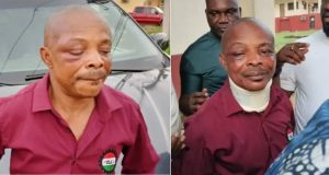 Ajaero in critical condition, may be flown abroad -NLC Ajaero in critical condition, may be flown abroad -NLC