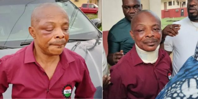 Ajaero in critical condition, may be flown abroad -NLC