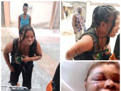 Woman left unrecognizable as ''husband pours her acid, st*bs her'' [photos]