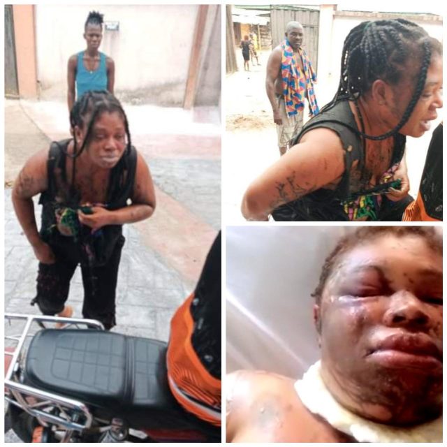 Woman left unrecognizable as ''husband pours her acid, st*bs her'' [photos]