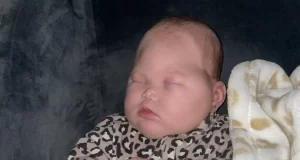 “Miracle” baby was born without eyes and had half her brain removed baby was born without eyes and had half her brain removed