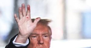 Mysterious red marks seen on Trump’s hand Trump's courtroom naps spark concerns of dementia, expert says