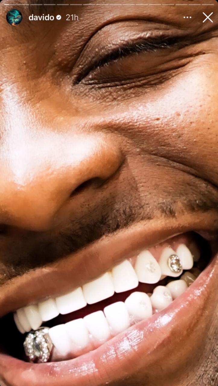 Davido shows off new gold necklace, diamond teeth
