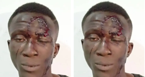 Photo: Notorious Abuja armed robber arrested Police arrest notorious armed robber for stabbing victim over iPhone in Abuja