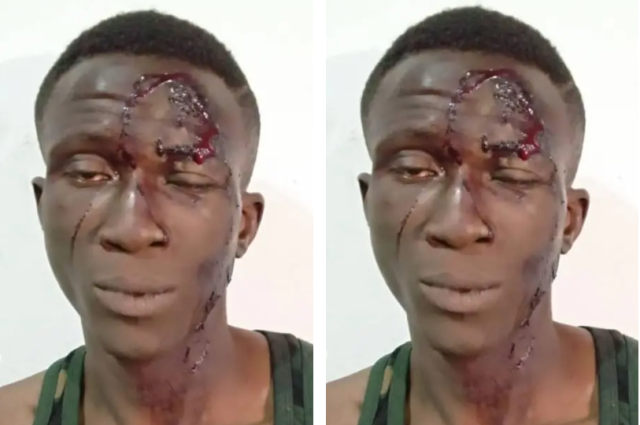 Police arrest notorious armed robber for stabbing victim over iPhone in Abuja Police arrest notorious armed robber for stabbing victim over iPhone in Abuja