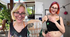 The woman allergic to semen The woman allergic to semen