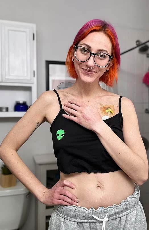 Image of Allison Tennyson with sperm allergy