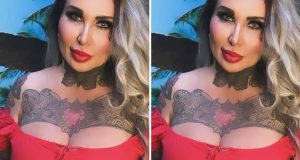 Brazilian model who wants Pamela Anderson’s looks, gets a wrong boob job; that she can’t even clap her hands Brazilian model who wants Pamela Anderson's looks, gets a wrong boob job; that she can't even clap her hands