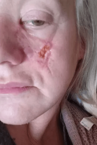 Mom's face CHOPPED OFF by friend's dog