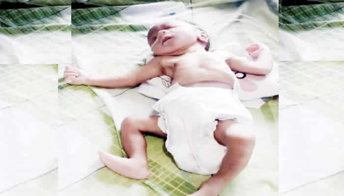 Day-old baby dumped in polythene bag RESCUED