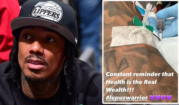 Nick Cannon says he's a 'lupus warrior' as he undergoes blood treatment