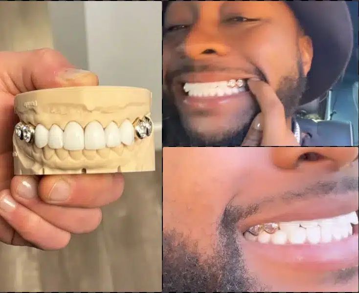 Davido Flaunts expensive diamond teeth worth N215millions