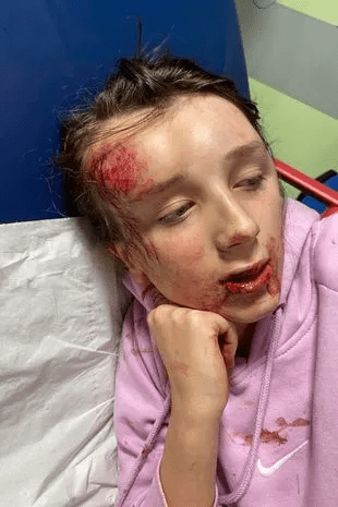 Mum of beaten autistic girl begs that people stop sharing video of the beating