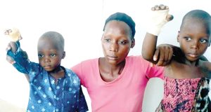 Woman burns hands of stepchildren for eating rice she cooked for their father Woman burns hands of stepchildren for eating rice she cooked for their father