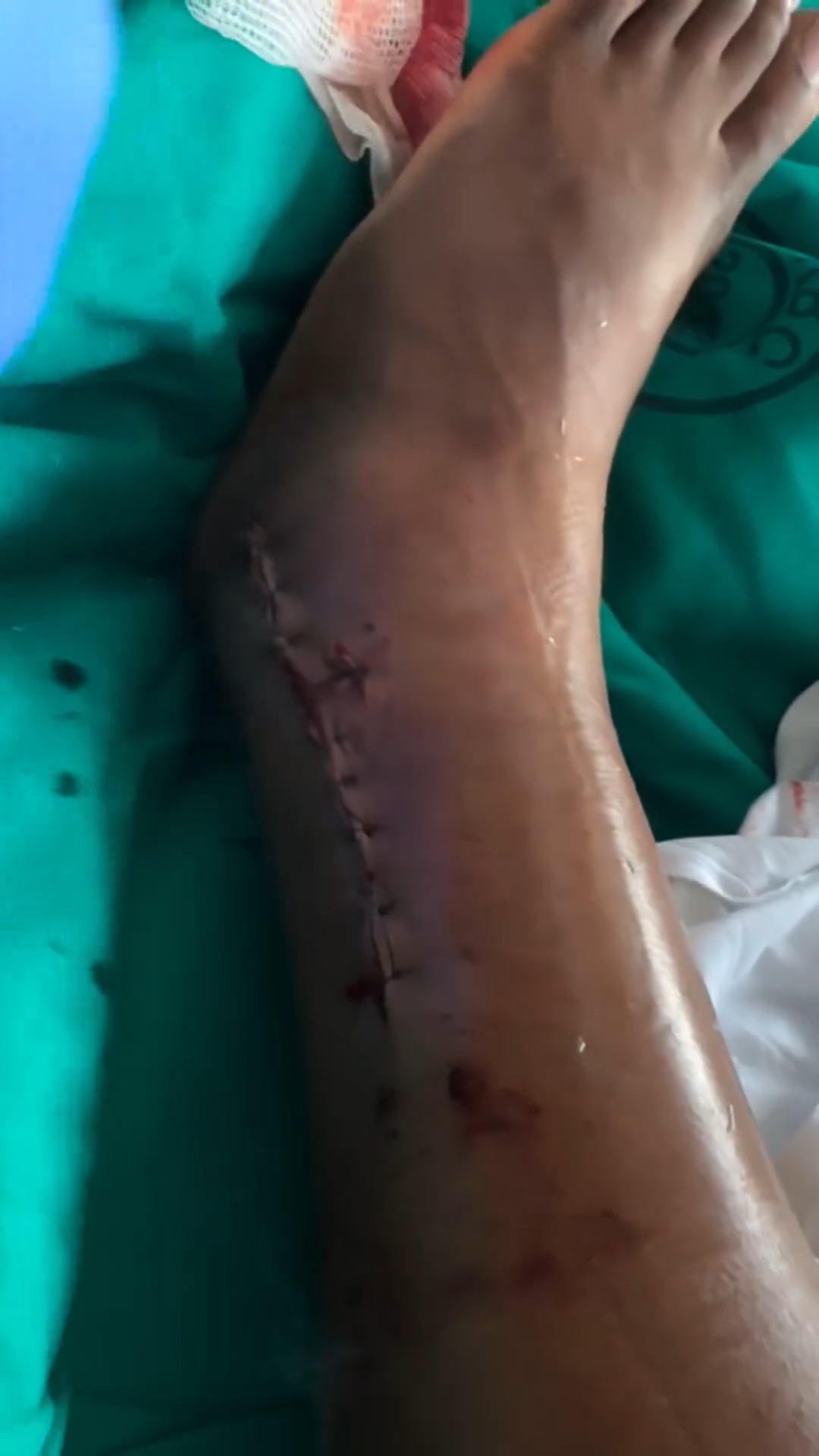 Actress Idia Aisien speaks on the accident that almost made her paralyzed