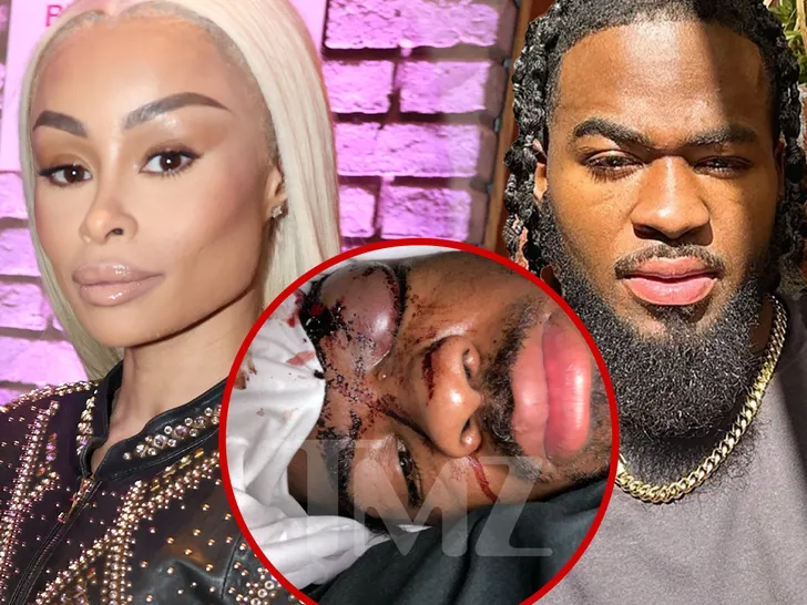 Blac Chyna SUED by ex-boyfriend claiming she hit him as he slept Blac Chyna SUED by ex-boyfriend claiming she hit him as he slept