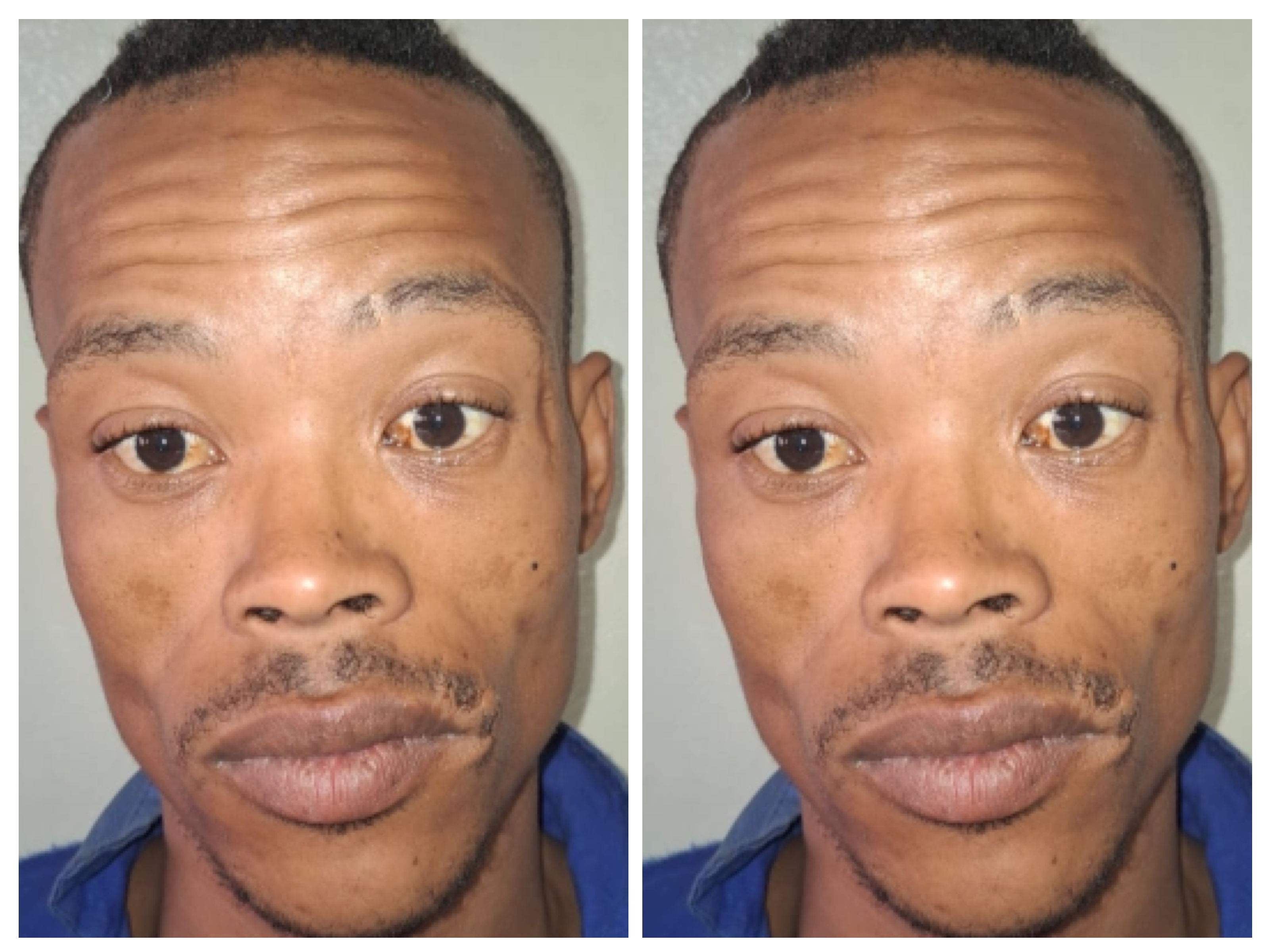 A 29-year-old man, Jeremy Bosman, has been arrested and charged with murder following the death of his three-year-old stepson, Charvandre Kieran Everson, reportedly due to Bosman’s violent reaction after the child wet the bed. A 29-year-old man, Jeremy Bosman, has been arrested and charged with murder following the death of his three-year-old stepson, Charvandre Kieran Everson, reportedly due to Bosman’s violent reaction after the child wet the bed.