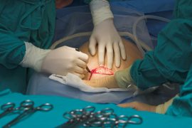 FG announces free Cesarean sections for Nigerian women FG announces free Cesarean sections for Nigerian women