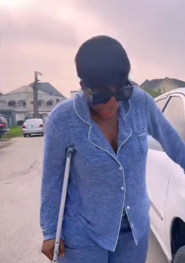 Destiny Etiko dislocates leg on movie set