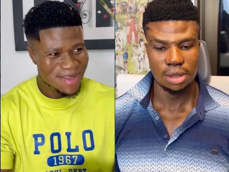 Zicsaloma reveals new look after undergoing nose Surgery Zicsaloma reveals new look after undergoing nose Surgery
