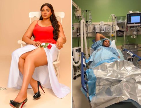 Omotola Jalade Ekeinde promotes Self-Love, embraces her scar Omotola Jalade Ekeinde promotes Self-Love, embraces her scar